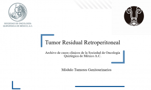 Tumores genitourinarios. Tumor residual retroperitoneal postquimio.